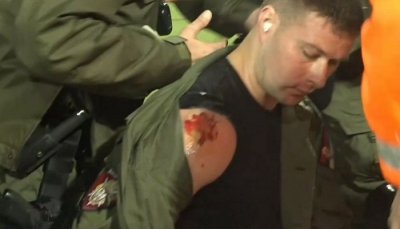 Жандарм повређен на дербију испред југа: Крвавом му указивали помоћ, па га извели са Маракане!